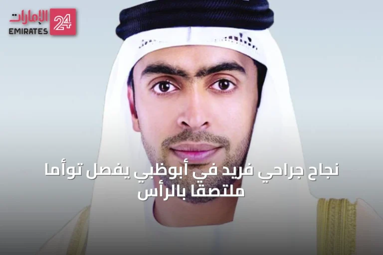 نجاح جراحي فريد في أبوظبي يفصل توأمًا ملتصقًا بالرأس