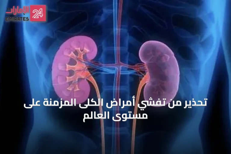 تحذير من تفشي أمراض الكلى المزمنة على مستوى العالم