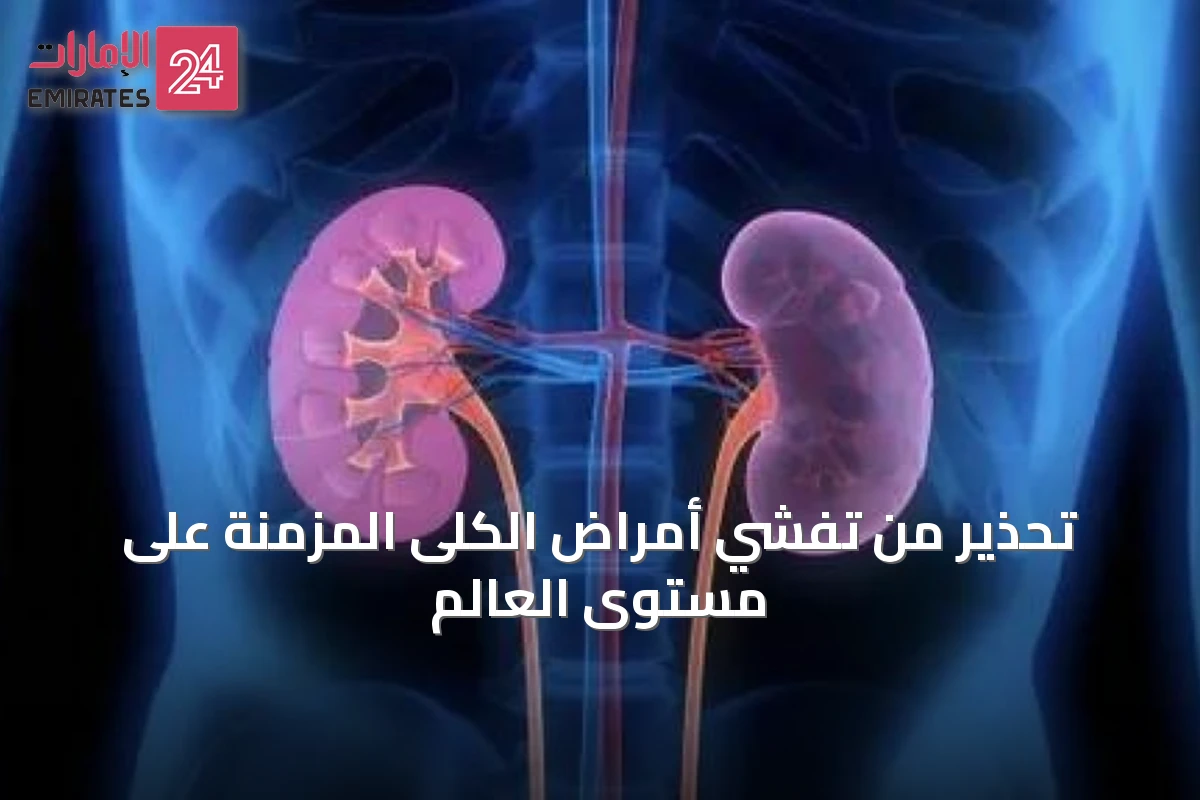 تحذير من تفشي أمراض الكلى المزمنة على مستوى العالم