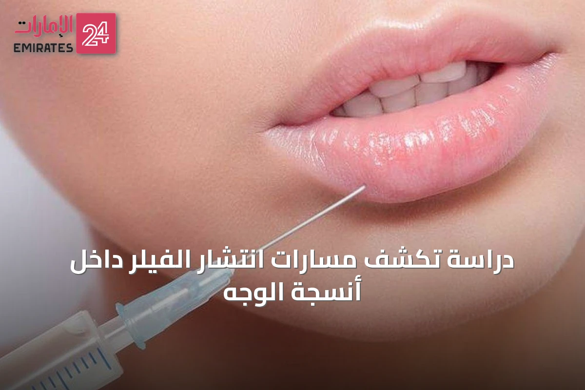 دراسة تكشف مسارات انتشار الفيلر داخل أنسجة الوجه