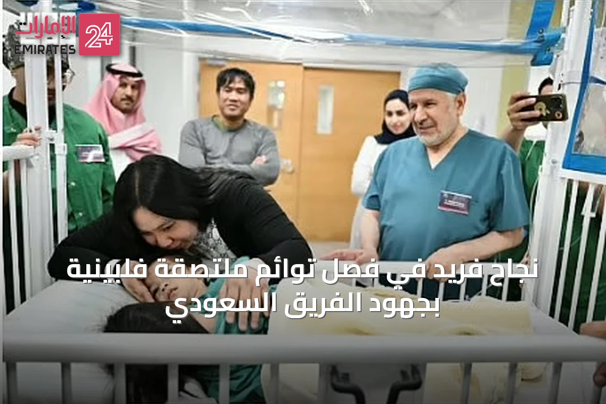نجاح فريد في فصل توائم ملتصقة فلبينية بجهود الفريق السعودي