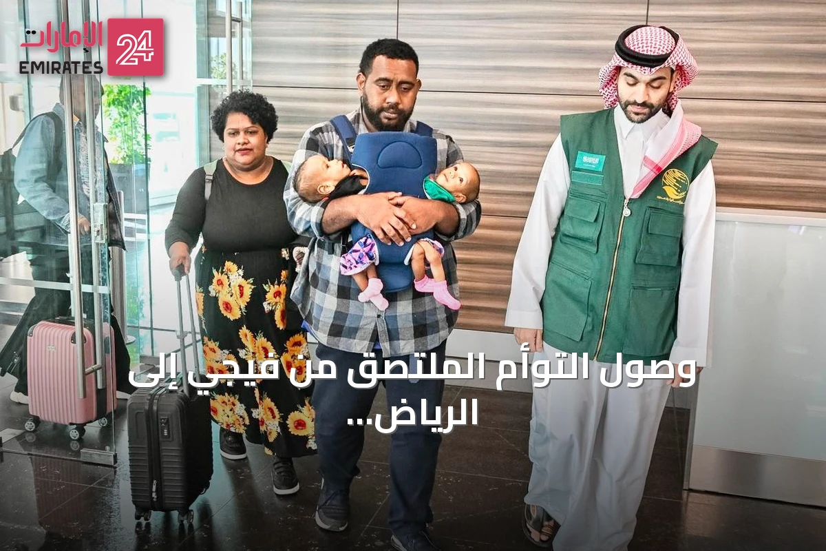 وصول التوأم الملتصق من فيجي إلى الرياض لدراسة حالتهما والنظر في إمكانية فصلهما