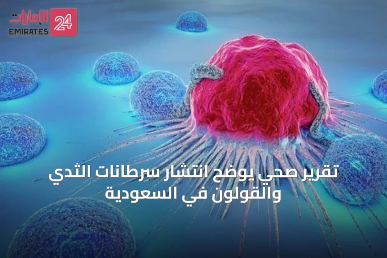 تقرير صحي يوضح انتشار سرطانات الثدي والقولون في السعودية