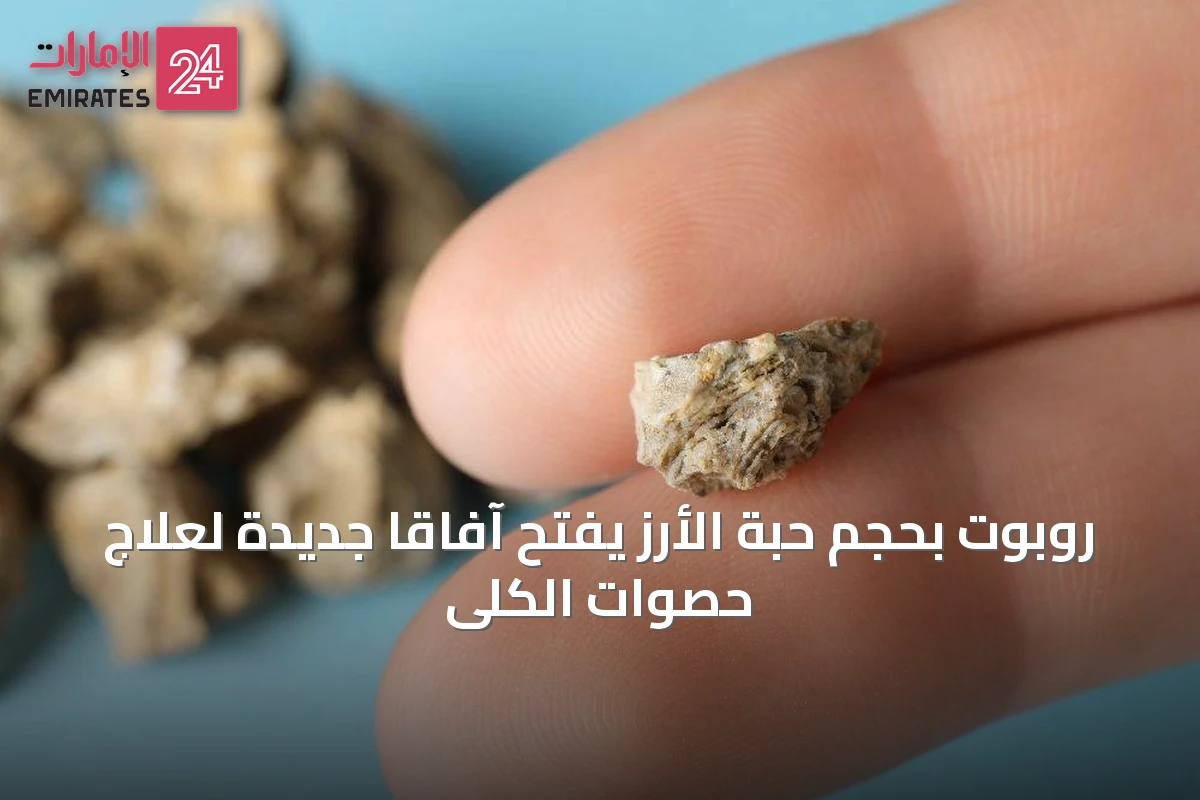 روبوت بحجم حبة الأرز يفتح آفاقاً جديدة لعلاج حصوات الكلى