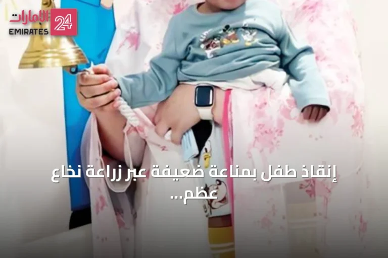 إنقاذ طفل بمناعة ضعيفة عبر زراعة نخاع عظم نصف متطابق في أبوظبي