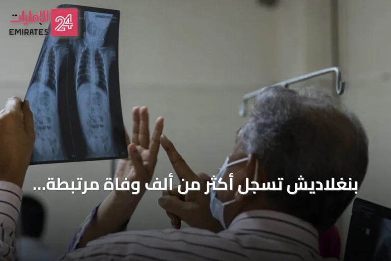 بنغلاديش تسجل أكثر من ألف وفاة مرتبطة بالحصبة
