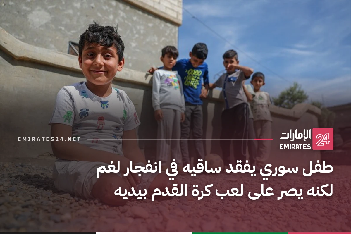 طفل سوري يفقد ساقيه في انفجار لغم لكنه يصر على لعب كرة القدم بيديه