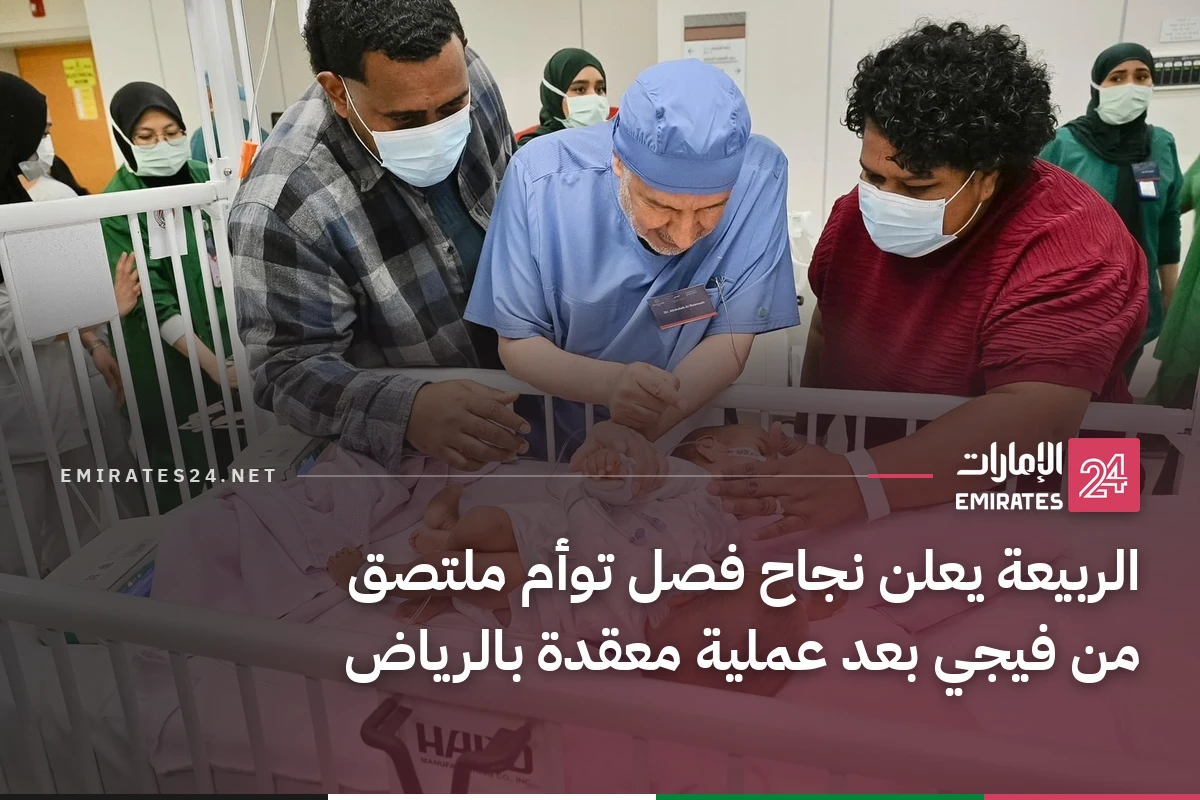 الربيعة يعلن نجاح فصل توأم ملتصق من فيجي بعد عملية معقدة بالرياض